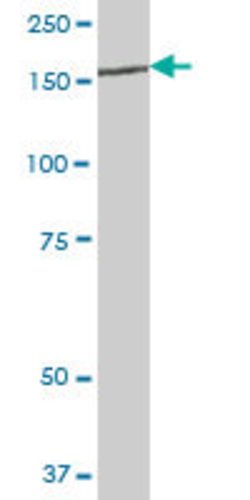 IARS, Mouse anti-Human, Polyclonal Antibody, Abnova 50&mu;g; Unconjugated:Antibodies,