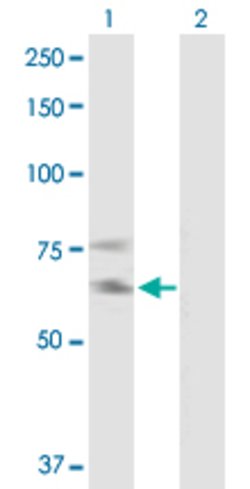 IL2RB, Mouse anti-Human, Polyclonal Antibody, Abnova 50&mu;g; Unconjugated:Antibodies,