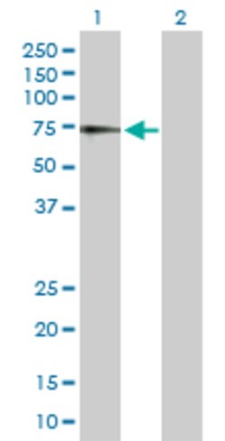 IL7R, Rabbit anti-Human, Polyclonal Antibody, Abnova 100 &mu;g | Buy Online | Abnova | Fisher Scientific