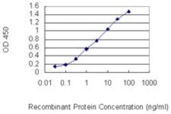 IL15, Mouse anti-Human, Clone: 1H6, Abnova 100 &mu;g | Buy Online | Abnova | Fisher Scientific
