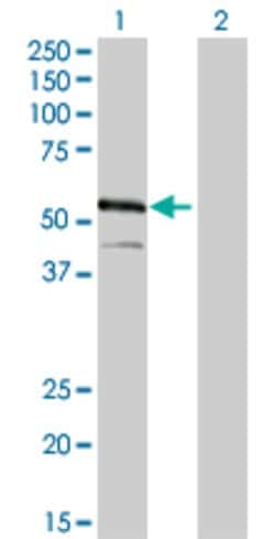 IRF4, Mouse anti-Human, Clone: 2F2, Abnova 100&mu;g; Unconjugated:Antibodies,