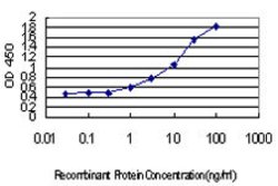 IRF4, Mouse anti-Human, Clone: 2F2, Abnova 100&mu;g; Unconjugated:Antibodies,