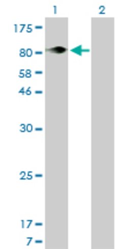 ITGB5, Mouse anti-Human, Clone: 2C4, Abnova 100&mu;g; Unconjugated:Antibodies,