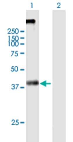 KCNN4, Mouse anti-Human, Polyclonal Antibody, Abnova 50&mu;g; Unconjugated:Antibodies,