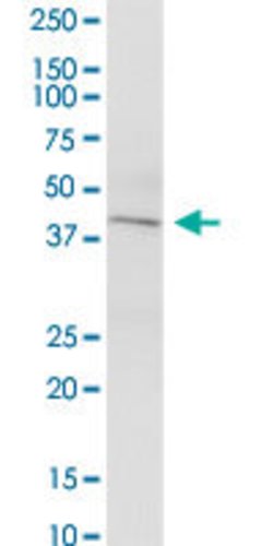 KCNN4, Mouse anti-Human, Polyclonal Antibody, Abnova 50&mu;g; Unconjugated:Antibodies,