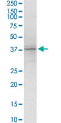 KIR2DL4, Rabbit anti-Human, Polyclonal Antibody, Abnova 100&mu;g; Unconjugated:Antibodies,