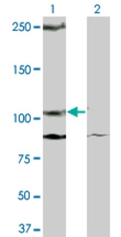 KIT, Mouse anti-Human, Clone: 2C3, Abnova 100&mu;g; Unconjugated:Antibodies,