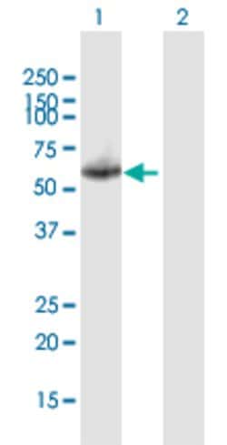 KNG1, Mouse anti-Human, Polyclonal Antibody, Abnova 50&mu;g; Unconjugated:Antibodies,