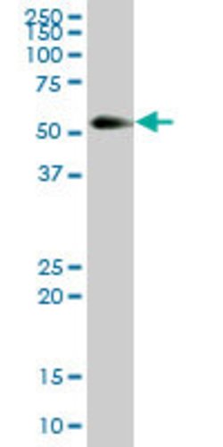 KNG1, Mouse anti-Human, Polyclonal Antibody, Abnova 50&mu;g; Unconjugated:Antibodies,