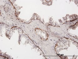 KRT15, Mouse anti-Human, Polyclonal Antibody, Abnova 50&mu;g; Unconjugated:Antibodies,