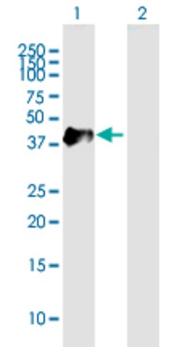 KRT19, Mouse anti-Human, Polyclonal Antibody, Abnova 50&mu;g; Unconjugated:Antibodies,