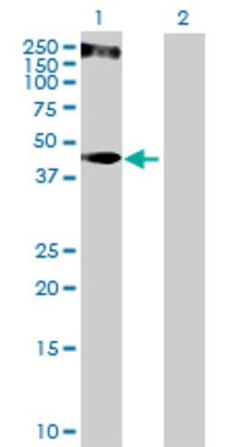 KRT34, Mouse anti-Human, Polyclonal Antibody, Abnova 50&mu;g; Unconjugated:Antibodies,