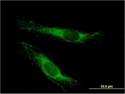 LSS, Mouse anti-Human, Clone: 2E4, Abnova 100&mu;g; Unconjugated:Antibodies,