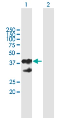 EPCAM, Mouse anti-Human, Polyclonal Antibody, Abnova 50&mu;g; Unconjugated:Antibodies,