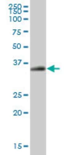EPCAM, Mouse anti-Human, Polyclonal Antibody, Abnova 50&mu;g; Unconjugated:Antibodies,