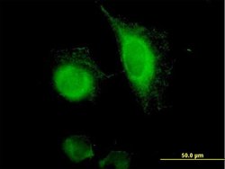 EPCAM, Mouse anti-Human, Polyclonal Antibody, Abnova 50&mu;g; Unconjugated:Antibodies,