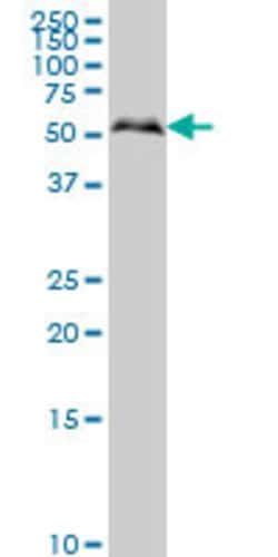 SMAD1, Mouse anti-Human, Clone: 2E9, Abnova 100&mu;g; Unconjugated:Antibodies,