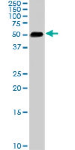 SMAD1, Mouse anti-Human, Clone: 2E9, Abnova 100&mu;g; Unconjugated:Antibodies,