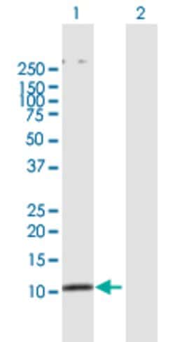 SMAD3, Rabbit anti-Human, Polyclonal Antibody, Abnova 100&mu;g; Unconjugated:Antibodies,