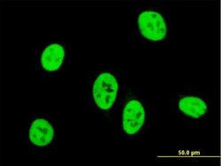 SMAD3, Mouse anti-Human, Clone: 2G4, Abnova 100 &mu;g | Buy Online | Abnova | Fisher Scientific