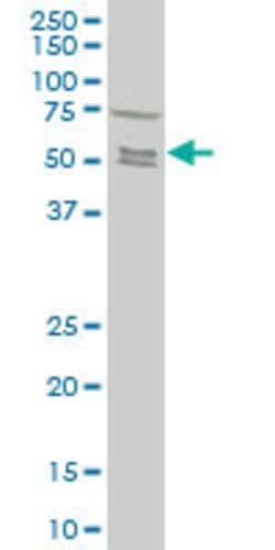 SMAD5, Mouse anti-Human, Clone: 4F10, Abnova 100&mu;g; Unconjugated:Antibodies,