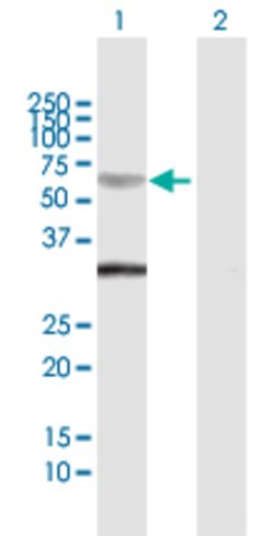 SMAD6, Rabbit anti-Human, Polyclonal Antibody, Abnova 100&mu;L; Unconjugated:Anticuerpos