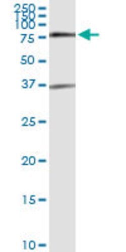 SMAD6, Rabbit anti-Human, Polyclonal Antibody, Abnova 100&mu;L; Unconjugated:Anticuerpos