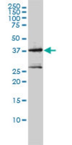 MAGEA2, Mouse anti-Human, Clone: 1H4, Abnova 100&mu;g; Unconjugated:Antibodies,