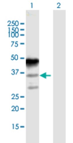 MAGEA8, Rabbit anti-Human, Polyclonal Antibody, Abnova 100 &mu;L | Buy Online | Abnova | Fisher Scientific