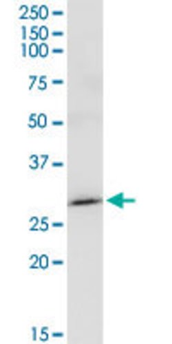 MAGEA8, Rabbit anti-Human, Polyclonal Antibody, Abnova 100 &mu;L | Buy Online | Abnova | Fisher Scientific