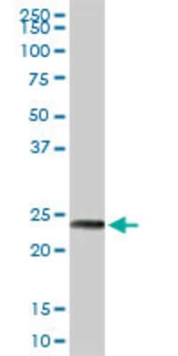 MAGEA8, Rabbit anti-Human, Polyclonal Antibody, Abnova 100 &mu;L | Buy Online | Abnova | Fisher Scientific