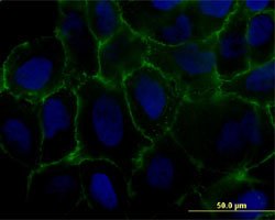 MCAM, Mouse anti-Human, Polyclonal Antibody, Abnova 50&mu;g; Unconjugated:Antibodies,