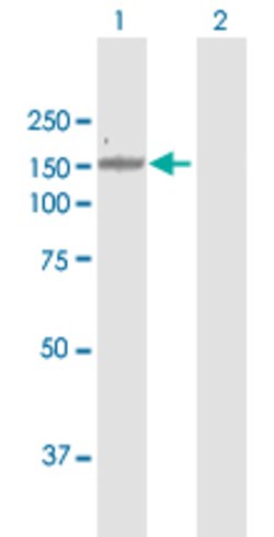MCM2, Rabbit anti-Human, Polyclonal Antibody, Abnova 100&mu;g; Unconjugated:Antibodies,
