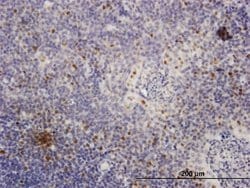 MCM4, Mouse anti-Human, Polyclonal Antibody, Abnova 50&mu;g; Unconjugated:Antibodies,
