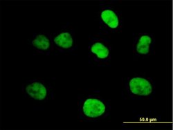 MCM4, Mouse anti-Human, Polyclonal Antibody, Abnova 50&mu;g; Unconjugated:Antibodies,