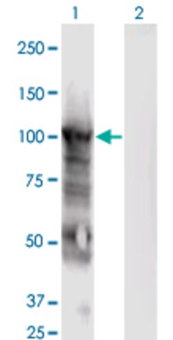 MCM6, Mouse anti-Human, Clone: 7D8, Abnova 100&mu;g; Unconjugated:Antibodies,