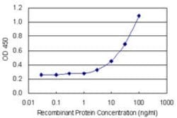 MCM6, Mouse anti-Human, Clone: 7D8, Abnova 100&mu;g; Unconjugated:Antibodies,
