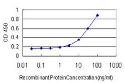 MEF2A, Mouse anti-Human, Clone: 3F6, Abnova 100&mu;g; Unconjugated:Antibodies,