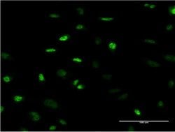 MEFV, Mouse anti-Human, Clone: 2C1, Abnova 100&mu;g; Unconjugated:Antibodies,