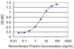 MEFV, Mouse anti-Human, Clone: 2C1, Abnova 100&mu;g; Unconjugated:Antibodies,