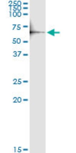 MITF, Rabbit anti-Human, Polyclonal Antibody, Abnova 100&mu;L; Unconjugated:Antibodies,