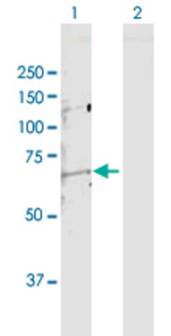 MMP14, Rabbit anti-Human, Polyclonal Antibody, Abnova 100&mu;g; Unconjugated:Antibodies,