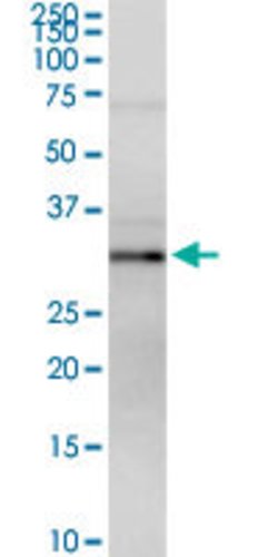 MPST, Rabbit anti-Human, Polyclonal Antibody, Abnova 100&mu;g; Unconjugated:Antibodies,