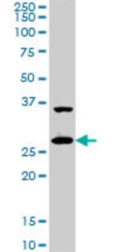 CITED1, Mouse anti-Human, Clone: 6G8, Abnova 100&mu;g; Unconjugated:Antibodies,