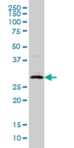 CITED1, Mouse anti-Human, Clone: 6G8, Abnova 100&mu;g; Unconjugated:Antibodies,