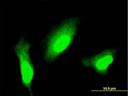 MSI1, Mouse anti-Human, Clone: 4A11, Abnova 100&mu;g; Unconjugated:Anticorps,