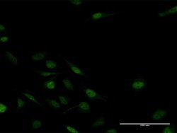 MSX2, Mouse anti-Human, Polyclonal Antibody, Abnova 50&mu;g; Unconjugated:Antibodies,