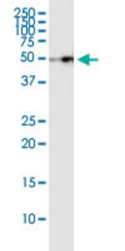 MVK, Rabbit anti-Human, Polyclonal Antibody, Abnova 100&mu;L; Unconjugated:Anticorps,