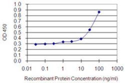 MYO1E, Mouse anti-Human, Clone: 7A5, Abnova 100&mu;g; Unconjugated:Antibodies,
