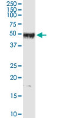 PPP1R12B, Rabbit anti-Human, Polyclonal Antibody, Abnova 100&mu;g; Unconjugated:Antibodies,